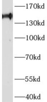 AFF4 Rabbit Polyclonal Antibody