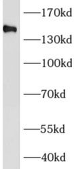 AFF4 Rabbit Polyclonal Antibody