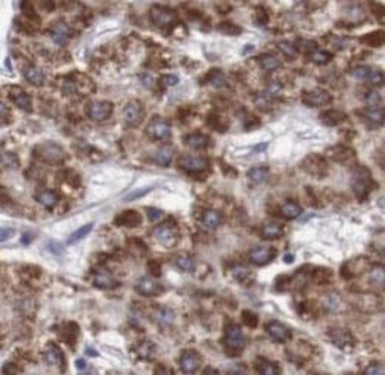 AFP Antibody