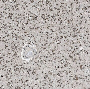 AGAP2 Antibody