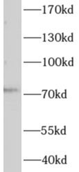 AGBL3 Antibody