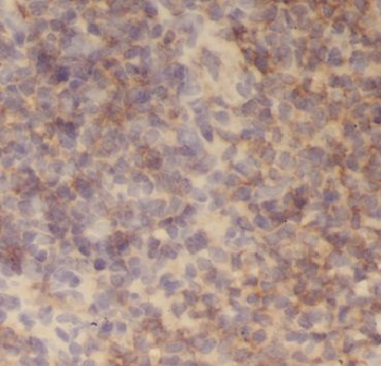 AGGF1 Antibody