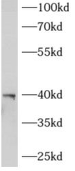 AGPAT3 Antibody