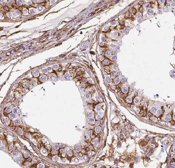 GPAT4 Antibody