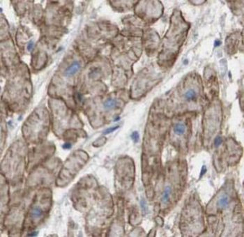 AGTR1 Antibody