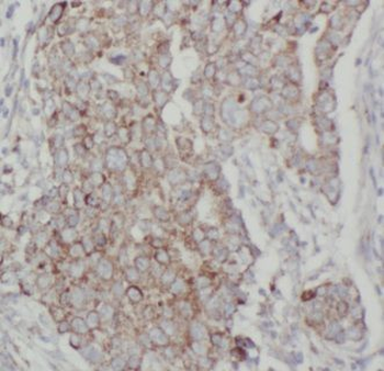 AHCY Antibody