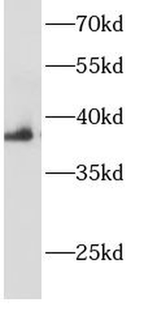 AHSA1 Antibody