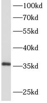 AIDA Antibody