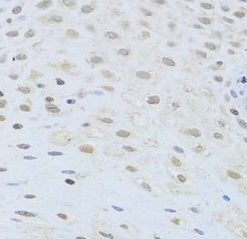 AIFM1 Antibody