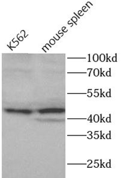 AIM2 Rabbit Polyclonal Antibody