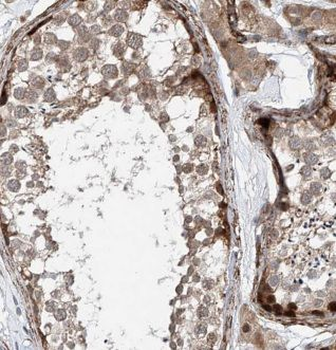 AIM2 Rabbit Polyclonal Antibody
