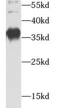 AIP Antibody