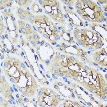 AIP Antibody