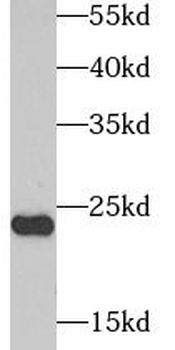 AK1 Antibody