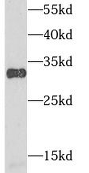 AK2 Rabbit Polyclonal Antibody