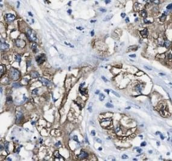 AK2 Rabbit Polyclonal Antibody