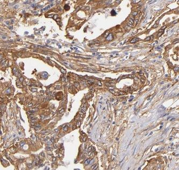 AK3 Antibody