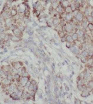 AK4 Antibody