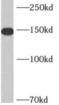 AKAP1 Antibody