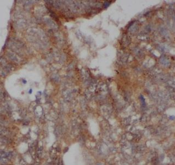 AKAP1 Antibody