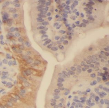 AKAP12 Antibody