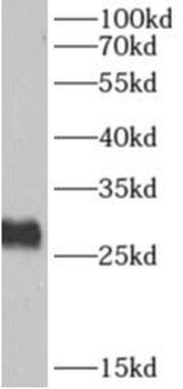 AKAP14 Rabbit Polyclonal Antibody
