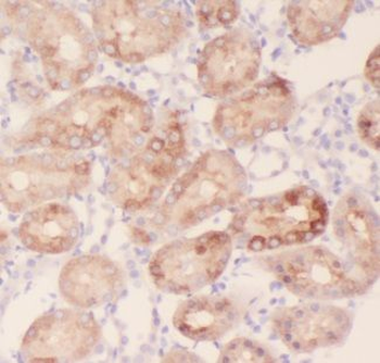 AKAP14 Antibody