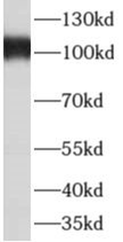 AKAP3 Antibody