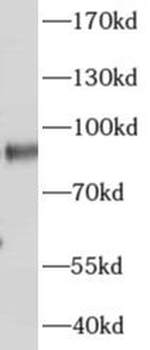 AKAP4 Antibody