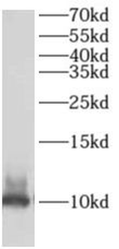 AKAP7 Antibody