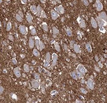 AKAP7 Antibody