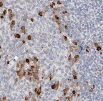 AKNA Antibody