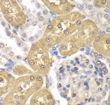 AKR1A1 Antibody