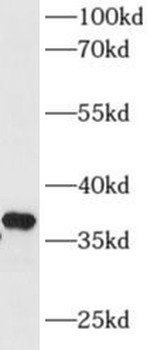 AKR1D1 Rabbit Polyclonal Antibody