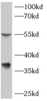 AKR7A3 Antibody