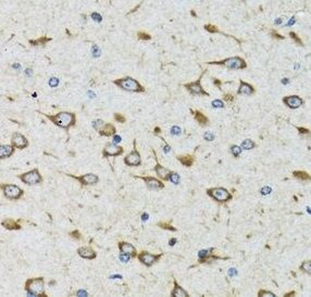 AKTIP Antibody