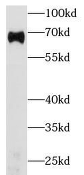ALB Antibody