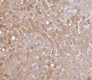 ALB Antibody