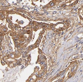 ALCAM Antibody