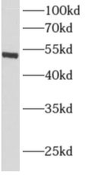 ALDH1A1 Antibody
