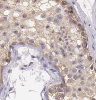 ALDH1B1 Antibody
