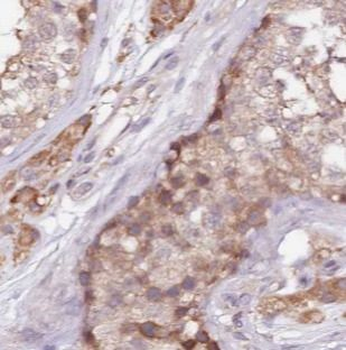ALDH1B1 Antibody