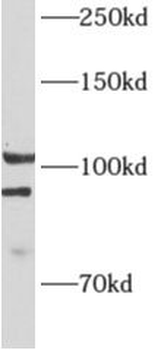 ALDH1L2 Antibody