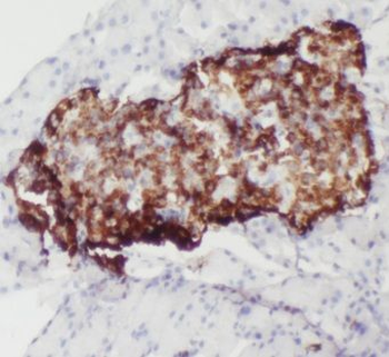 ALDH1L2 Antibody