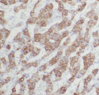 ALDH3B2 Antibody