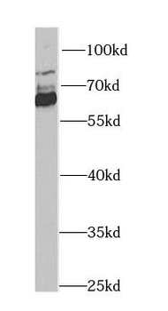 ALDH4A1 Rabbit Polyclonal Antibody