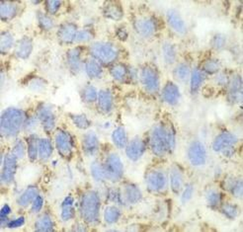 ALDH4A1 Rabbit Polyclonal Antibody