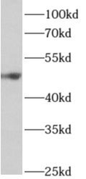 ALDH5A1 Antibody
