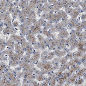 ALDH5A1 Antibody