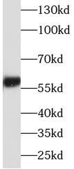 ALDH6A1 Rabbit Polyclonal Antibody